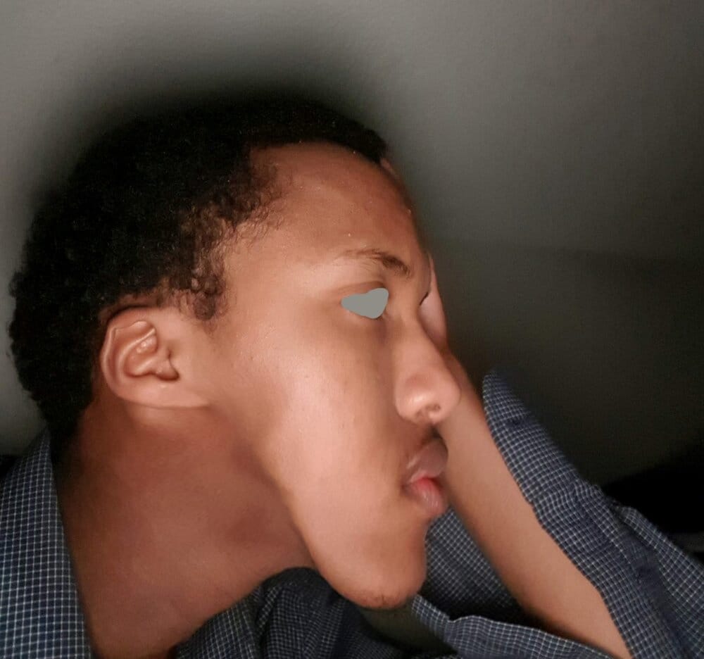 Somali man