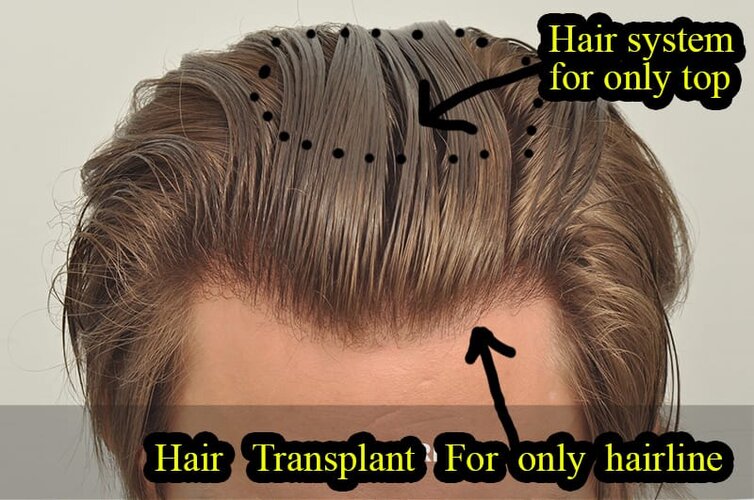 hairlines.jpg
