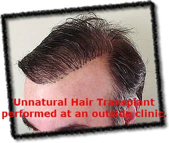 Unnnatural edit ht