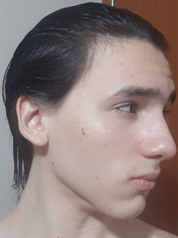 De lado