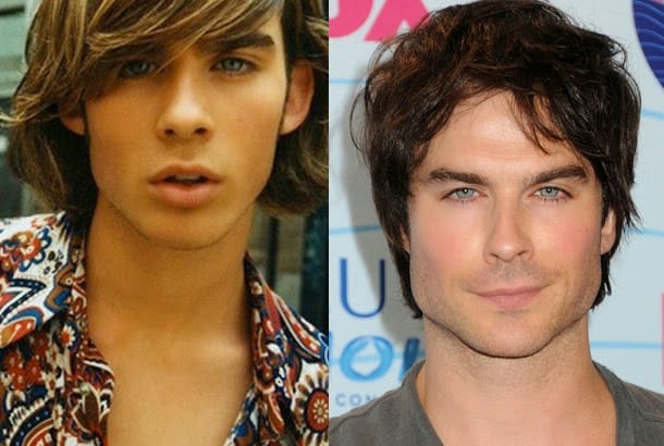 Ian Somerhalder Plastic Surgery 3
