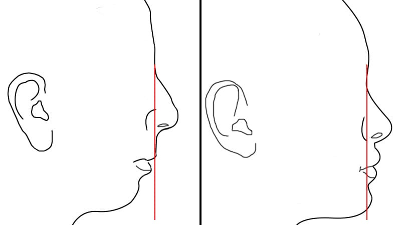 Recessed vs forward faces crop tilted tracing 2 4