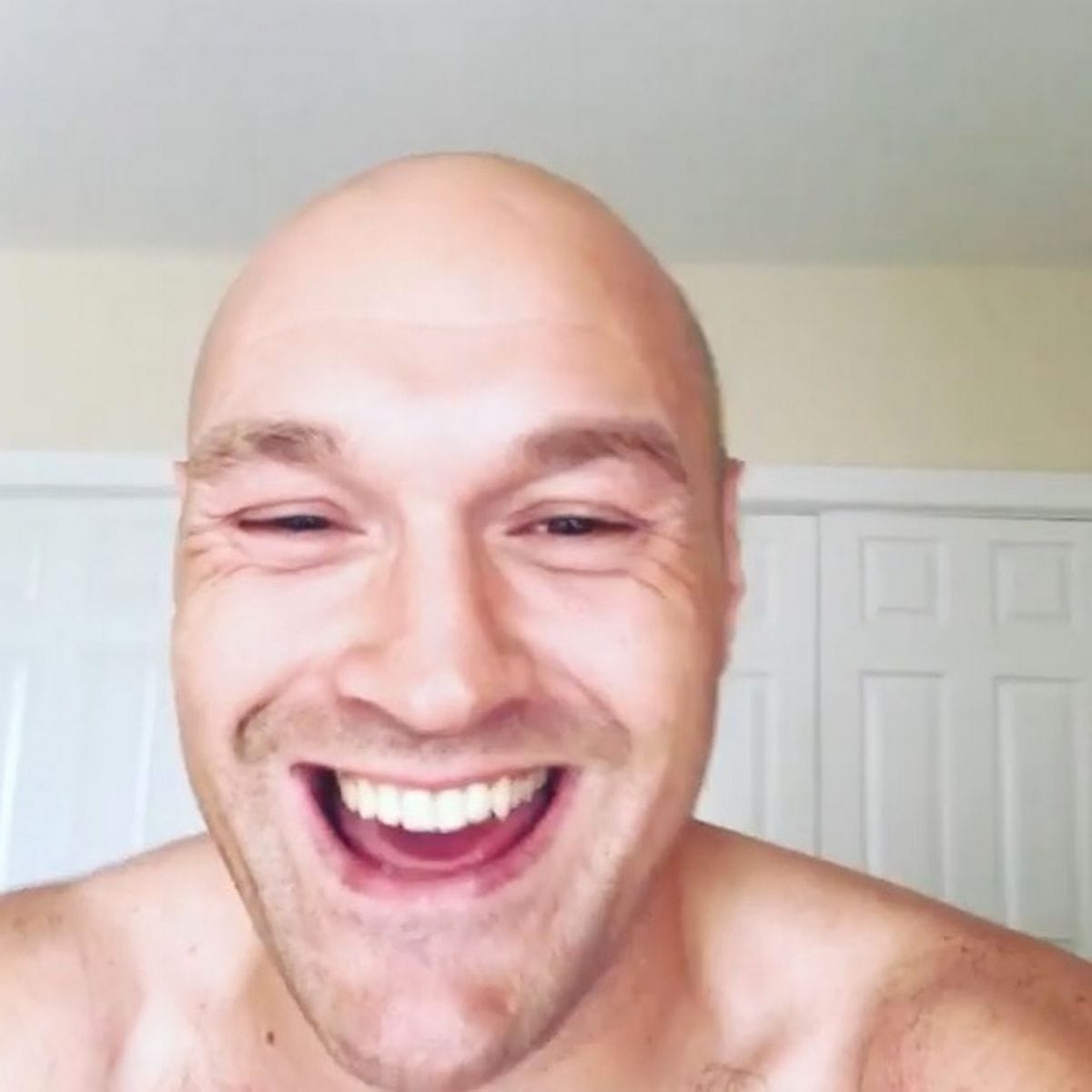 1 Tyson Fury