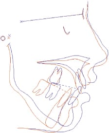 C9 fig 00020004