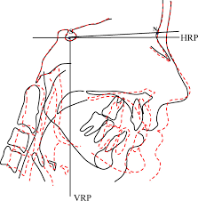 Images 2