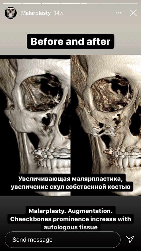 1D0B1167 8BAF 436B A7ED 63009C62054C