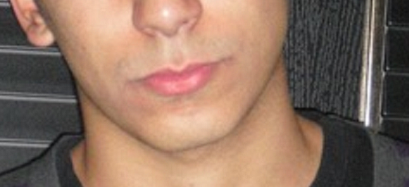 Front jaw picture