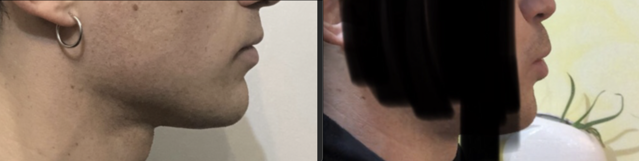 Badjawsurgery