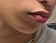 Chin