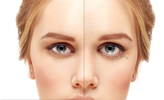 Istockphoto 647405374 170667a 2