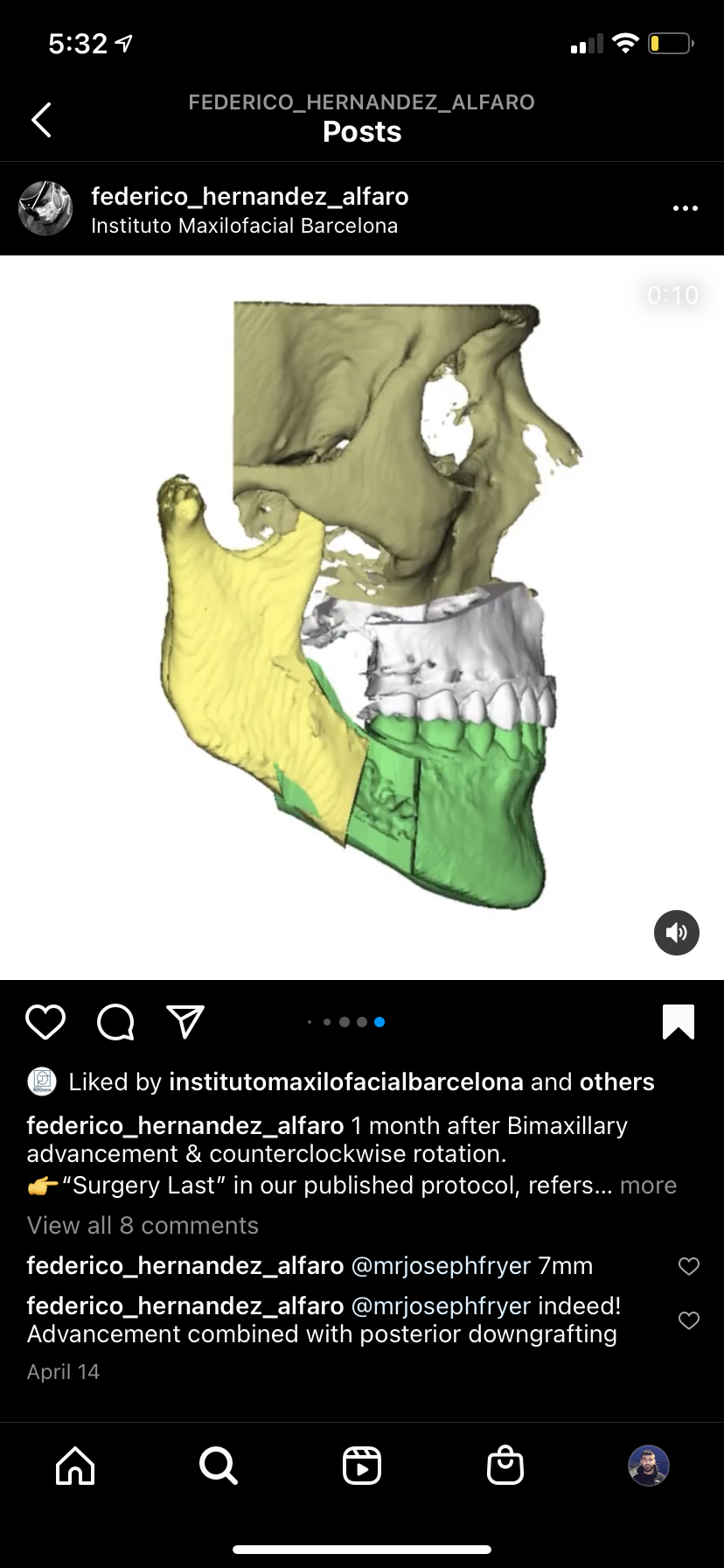 BEFCE578 DC29 420E 87CB ADEFD7AF8A0C