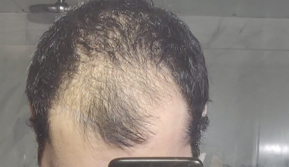 IMG 20210718 163212  01