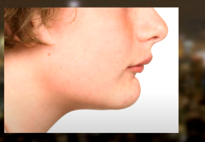 Chin