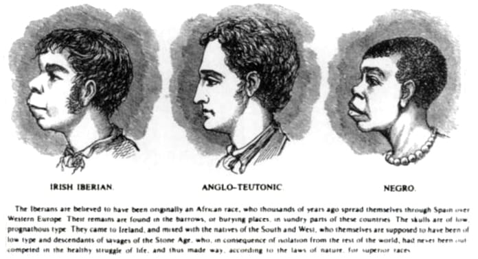 Scientific racism irish