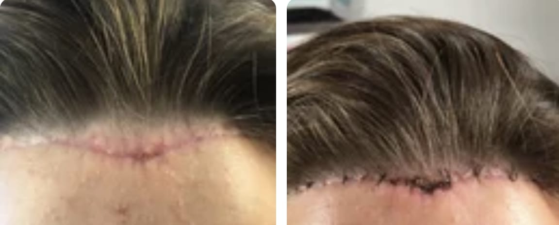 43D8BA71 1AD0 4A0F A6DE 0066AA98B6F0