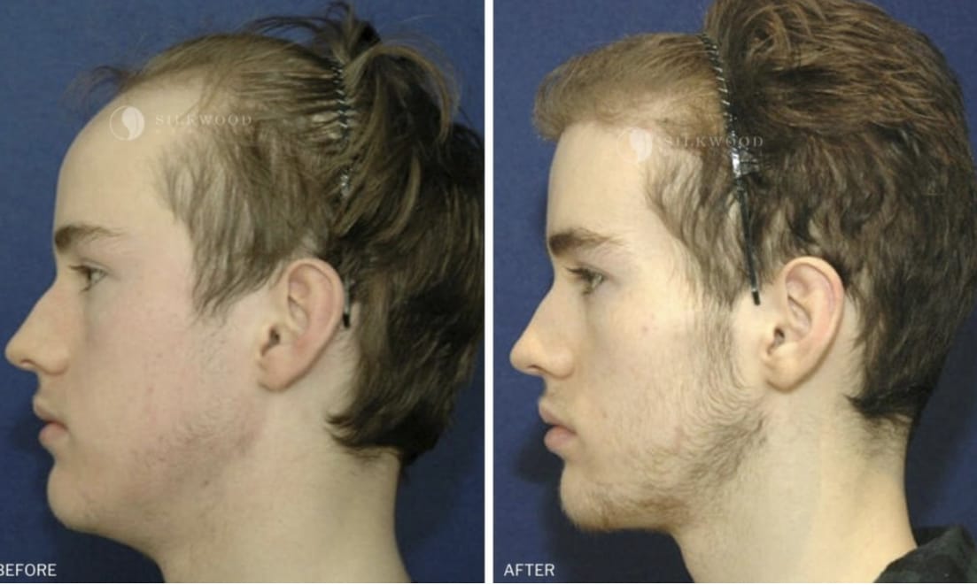 AE989B1B B4F7 401B BFE6 4B450840A853