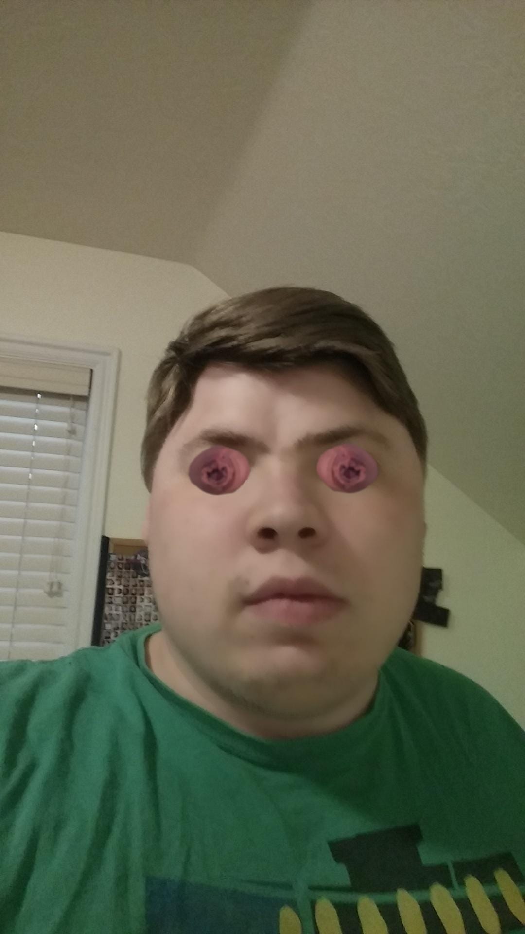 Cockeyedlossus
