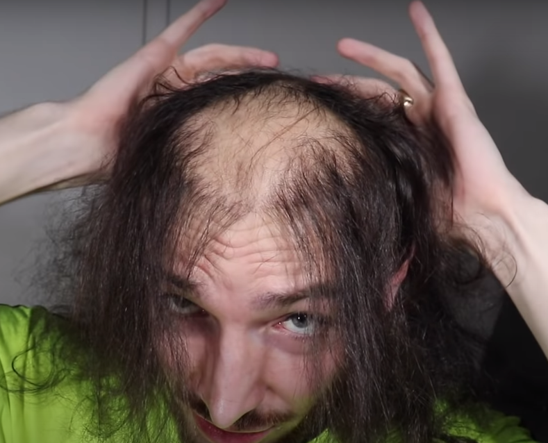 Bald