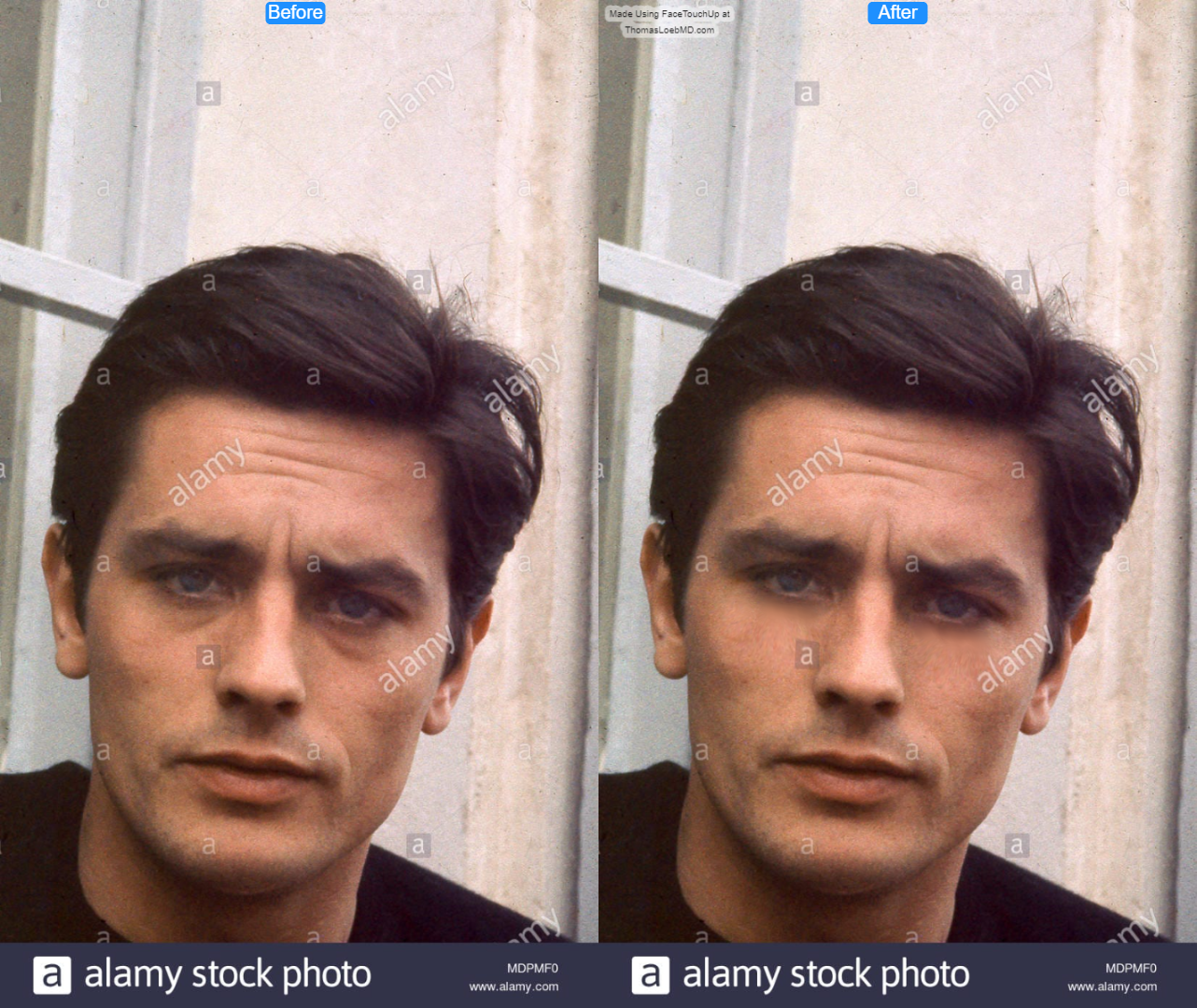 Alain delon 60s MDPMF0 before after