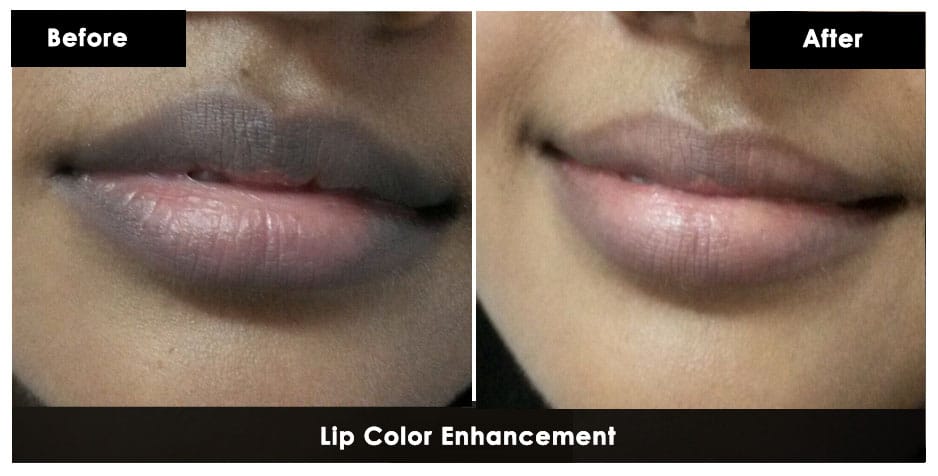 Lip color enhancement 1