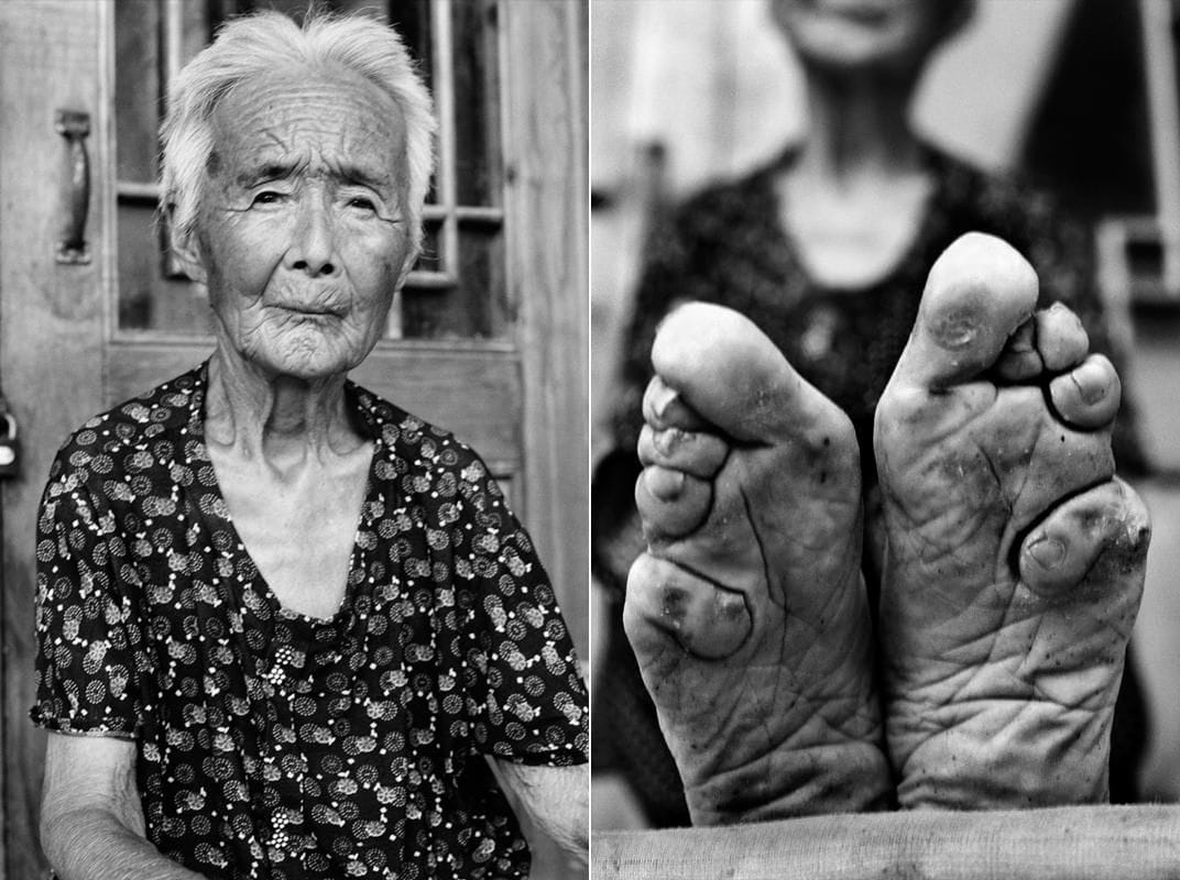 Feet