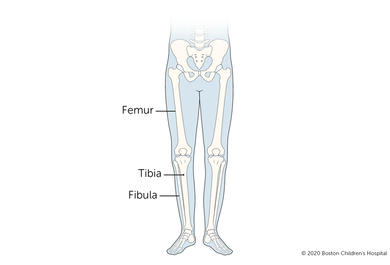 Broken leg bones 2400