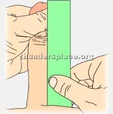 Images 36