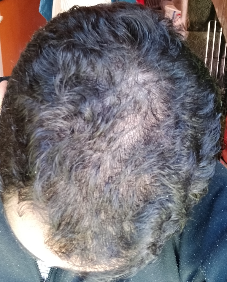 Month 1