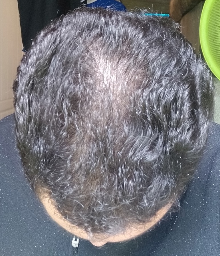 Month 2