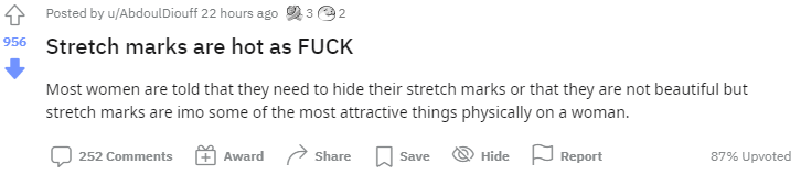 Stretch marks