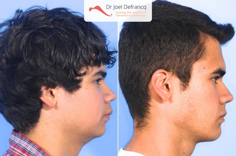 Dr Joel Defrancq 1457274102046258400 2015 1