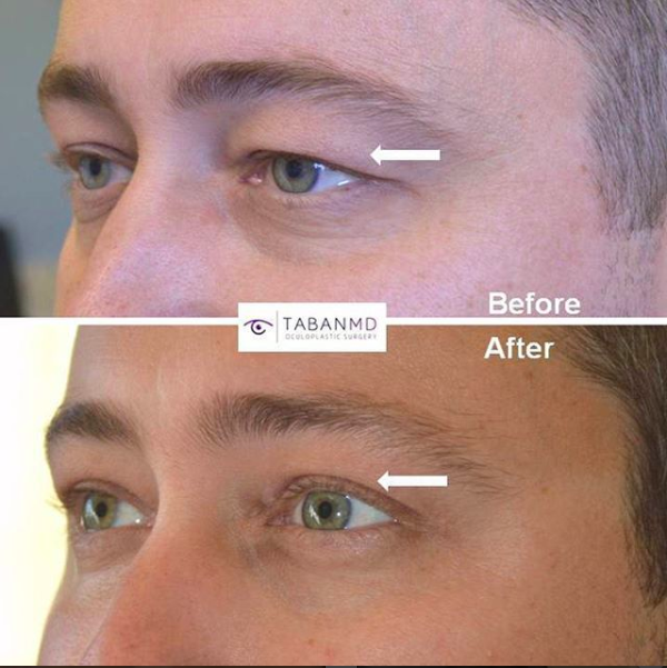 3c4963c74038594e8a38510aabdccada