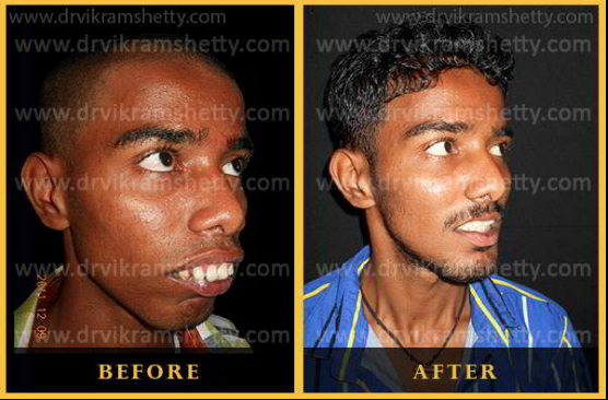 Bildschirmfoto 2020 04 01 um 005925