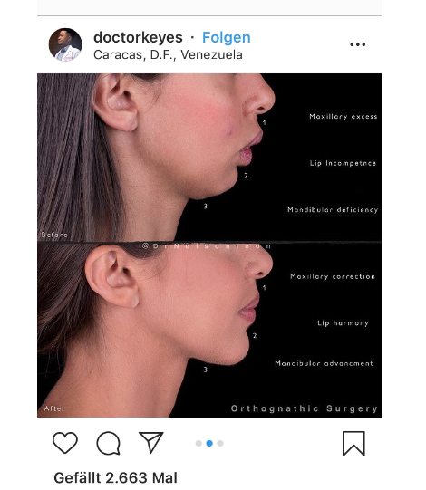 Bildschirmfoto 2020 09 27 um 160918