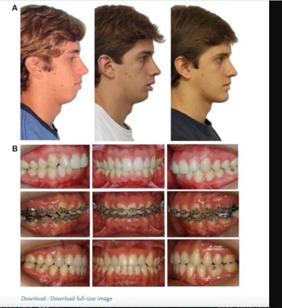 Bildschirmfoto 2020 11 04 um 153250