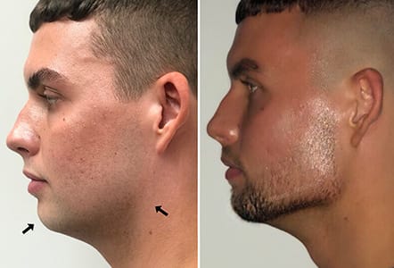 Ff126762e6129a8b873fc376e2c61e7d 1