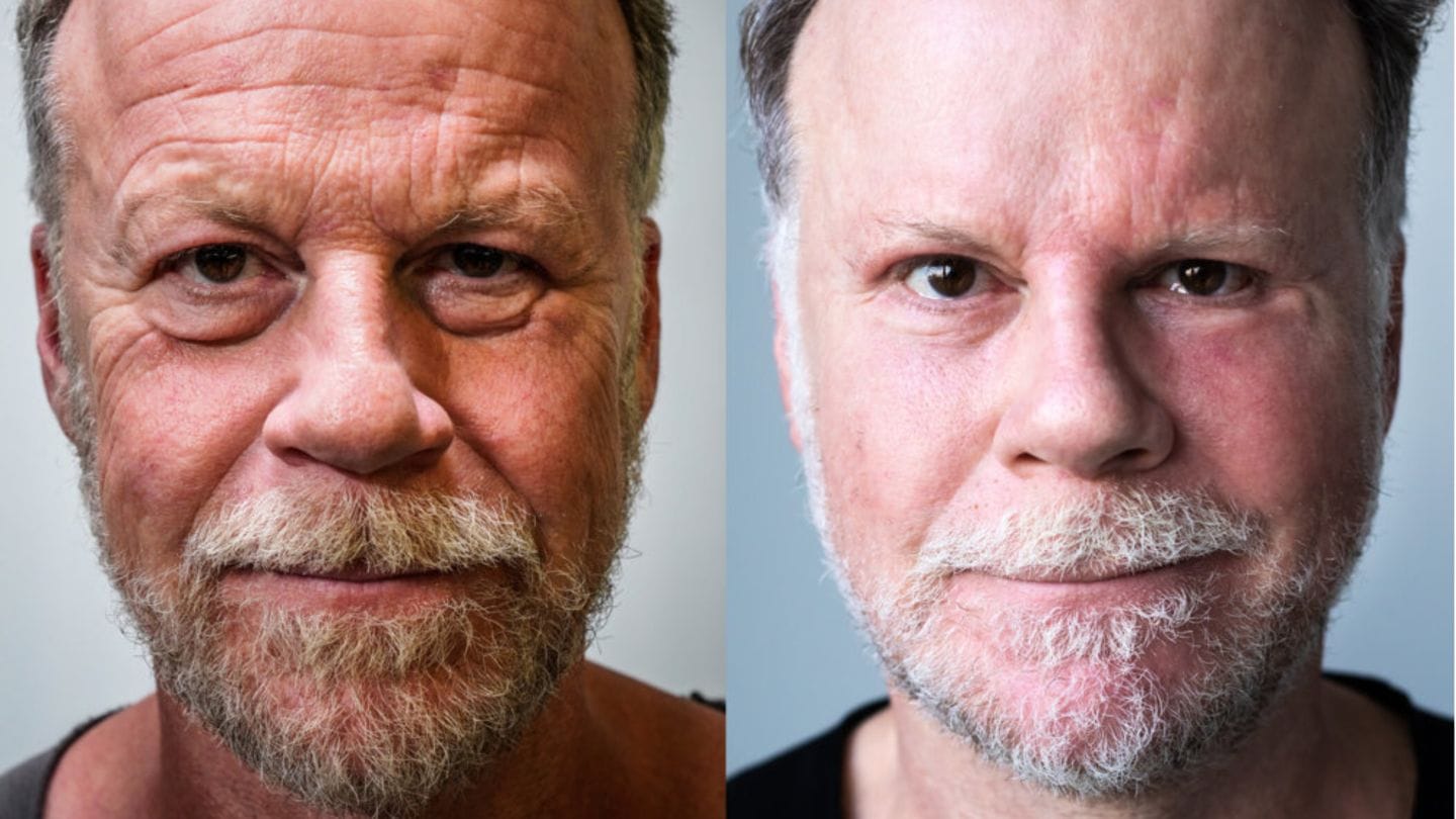 Jenke vorher nachher