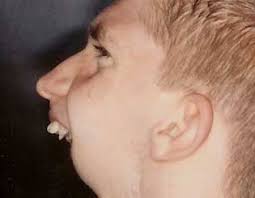 Images 8