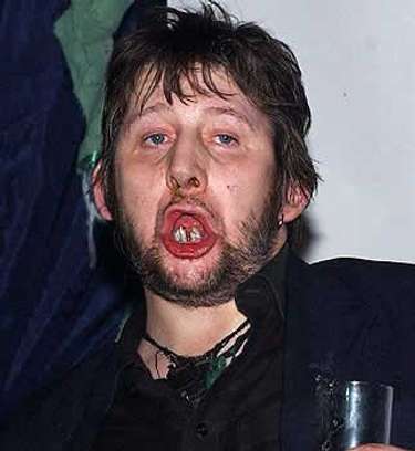 Shane macgowan recording artists and groups photo u1