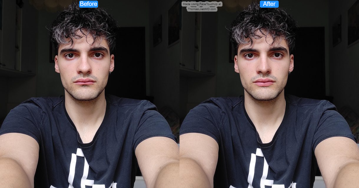7a0tSIcl before after