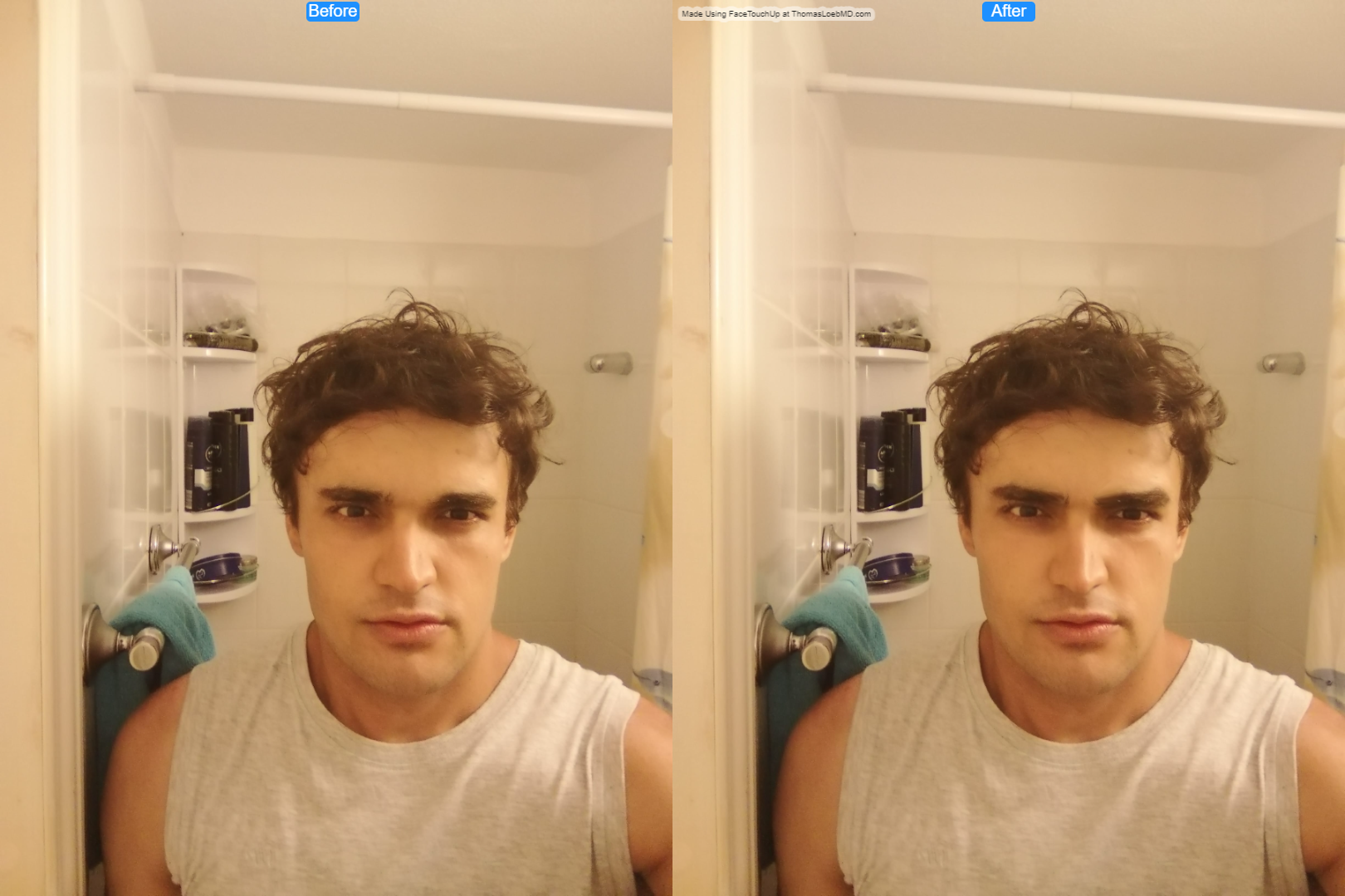 Autist