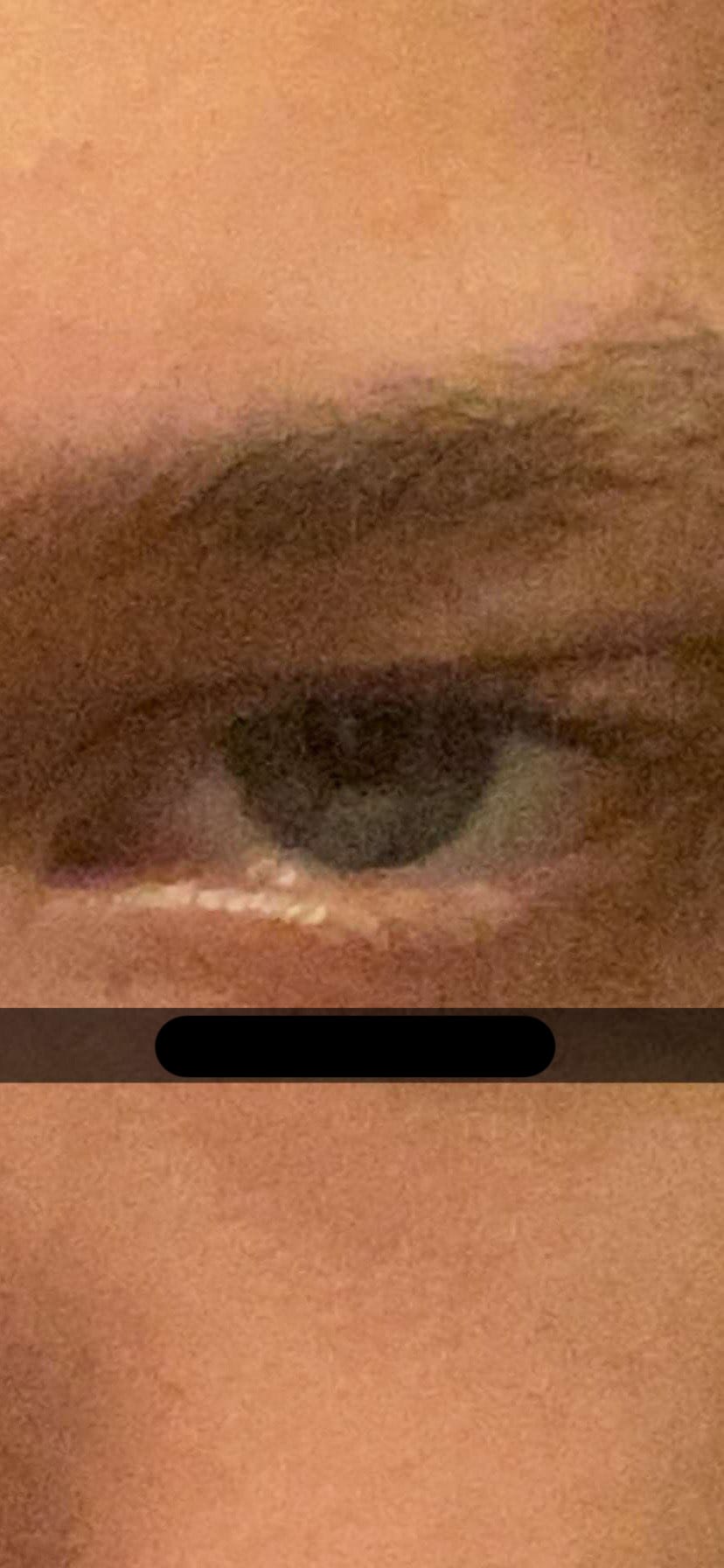 Eye
