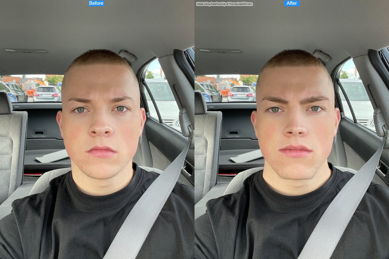 Germancel 1277 before after