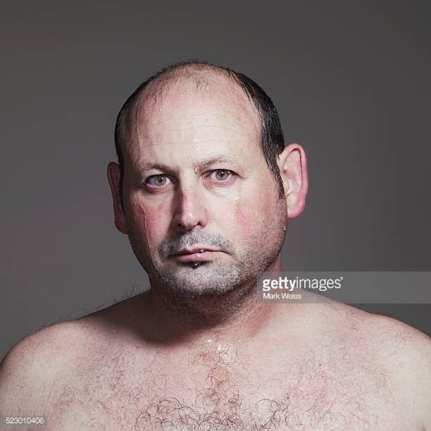 Bald