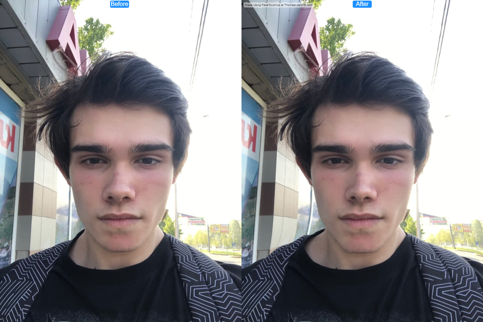 B1zey before after