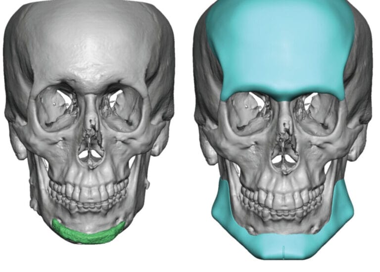 Image 1 768x550