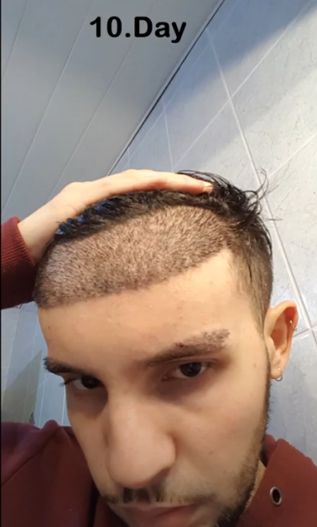 1631327393436
