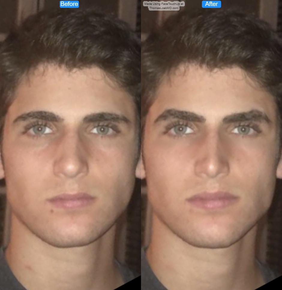 John babowski before after