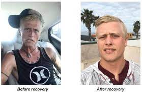 Heroin Effects on the Body - Before and After Pictures