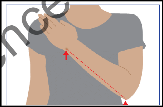 Measurement of Ulna Length
